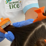 Bid Farewell To Lice: Effective Treatment Strategies